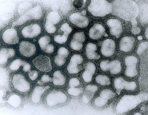 拡大したインフルエンザA型のウイルス